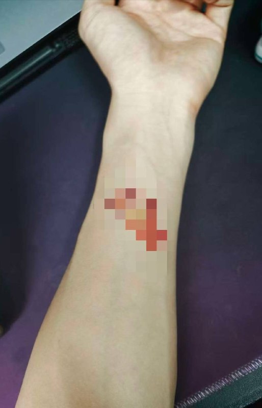 我好痛苦
