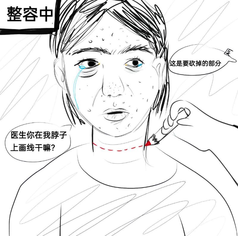 溜肩不砍掉吗